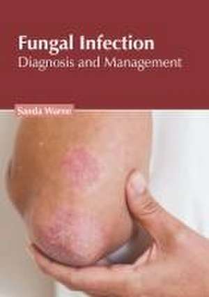 Fungal Infection: Diagnosis and Management de Sanda Warne