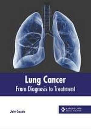 Lung Cancer: From Diagnosis to Treatment de Jute Cassie