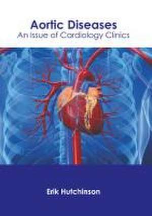 Aortic Diseases: An Issue of Cardiology Clinics de Erik Hutchinson