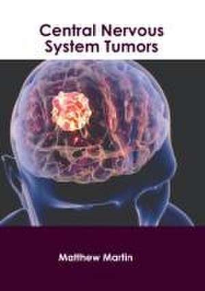 Central Nervous System Tumors de Matthew Martin