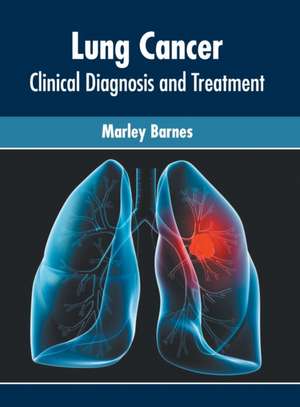 Lung Cancer: Clinical Diagnosis and Treatment de Marley Barnes