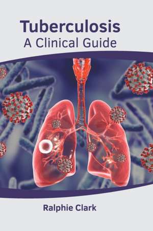 Tuberculosis: A Clinical Guide de Ralphie Clark