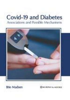 Covid-19 and Diabetes: Associations and Possible Mechanisms de Brie Madsen