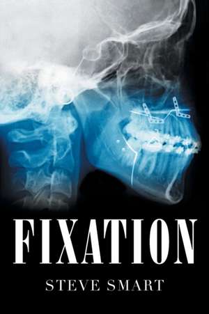 Fixation de Steve Smart