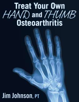 Treat Your Own Hand and Thumb Osteoarthritis de Jim Johnson