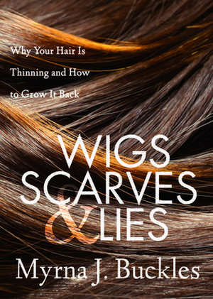 Wigs, Scarves & Lies de Myrna J. Buckles