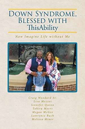 Down Syndrome, Blessed with ThisAbility de Craig Woodard Sr.