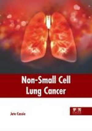 Non-Small Cell Lung Cancer de Jute Cassie