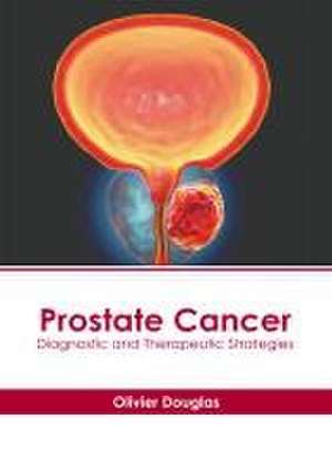 Prostate Cancer: Diagnostic and Therapeutic Strategies de Olivier Douglas