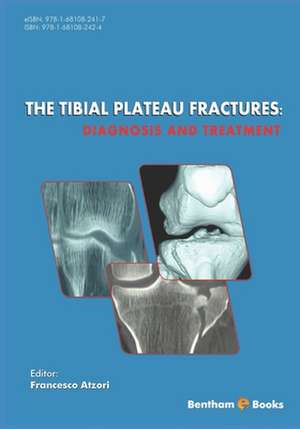 The Tibial Plateau Fractures: Diagnosis and Treatmment de Francesco Atzori