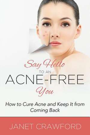 Say Hello to an Acne-Free You de Janet Crawford