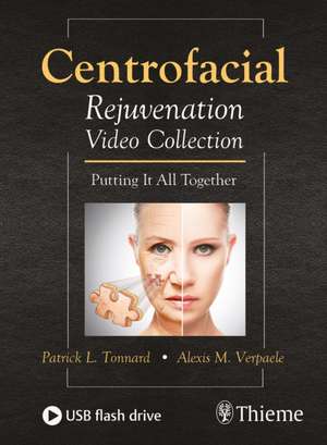 Centrofacial Rejuvenation Video Collection de Patrick Tonnard