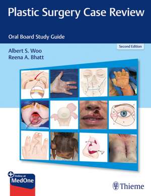 Plastic Surgery Case Review – Oral Board Study Guide de Albert S. Woo