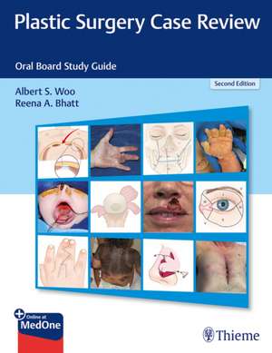 Plastic Surgery Case Review de Albert S. Woo