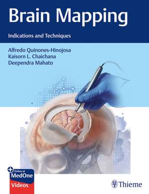 Brain Mapping: Indications and Techniques de Alfredo Quinones–hinojo