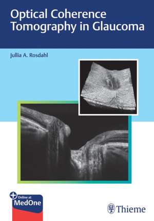 Optical Coherence Tomography in Glaucoma de J Rosdahl