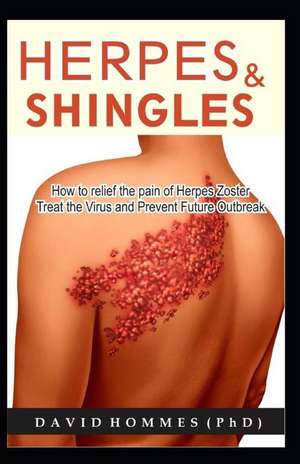 Herpes and Shingles: How to Relief the Pain of Herpes Zoster, Treat the Virus and Prevent Future Outbreak de David Hommes (Phd)