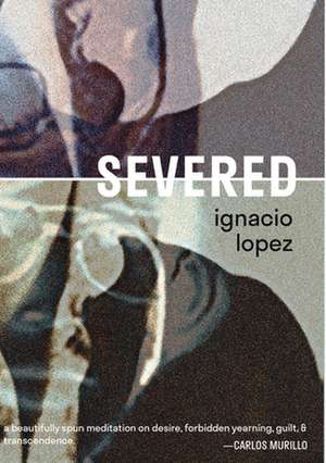 Severed de Ignacio Lopez