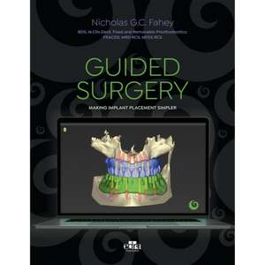 Guided Surgery - Making Implant Placement Simpler de G C Fahey Nicholas