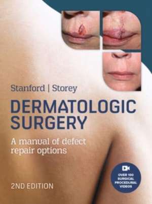 Dermatologic Surgery, 2nd Edition de Duncan Stanford