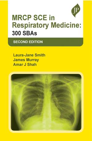 MRCP SCE in Respiratory Medicine: 300 SBAs de Laura-Jane Smith