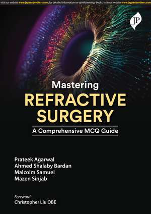 Mastering Refractive Surgery: A Comprehensive MCQ Guide de Prateek Agarwal