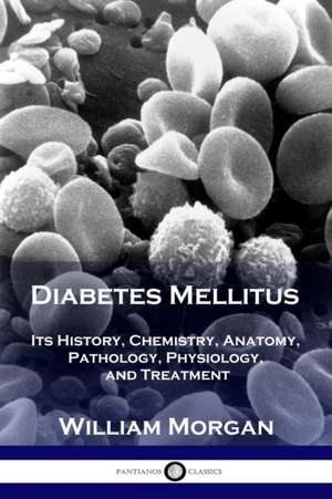 Diabetes Mellitus de William Morgan