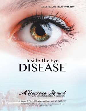 Inside the Eye Disease Just the Facts de Prince MD MBA-Healthcare Mgt MS-CVRT CLV