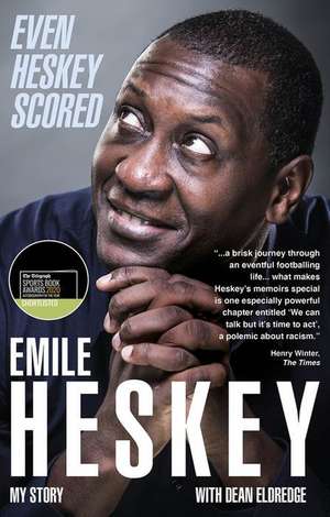 Even Heskey Scored de Emile Heskey