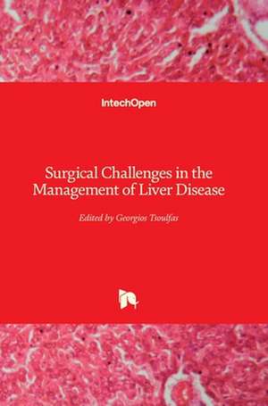 Surgical Challenges in the Management of Liver Disease de Georgios Tsoulfas