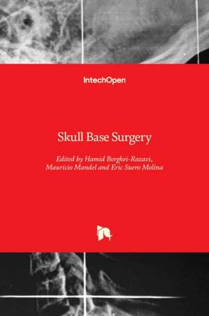 Skull Base Surgery de Hamid Borghei-Razavi
