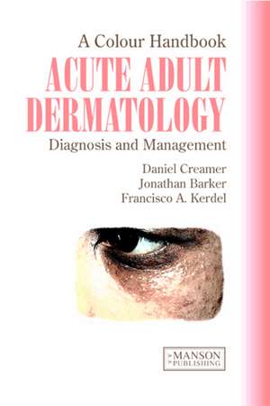 Acute Adult Dermatology: A Colour Handbook de Daniel Creamer