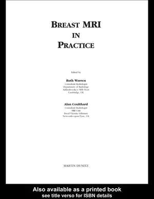 Breast MRI in Practice de Alan Coulthard