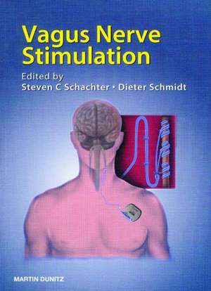 Vagus Nerve Stimulation de Steven C. Schachter