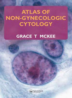 Atlas of Non-Gynecologic Cytology de Grace T. McKee