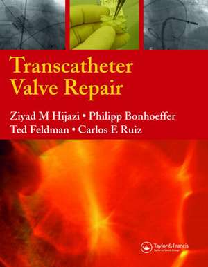 Transcatheter Valve Repair de Ziyad M. Hijazi