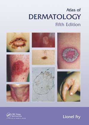 Atlas of Dermatology, Fifth Edition de Lionel Fry