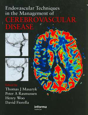 Endovascular Techniques in the Management of Cerebrovascular Disease de Thomas J. Masaryk