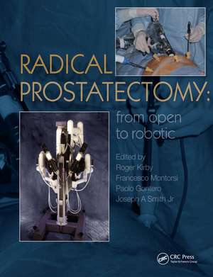 Radical Prostatectomy: From Open to Robotic de Roger Kirby