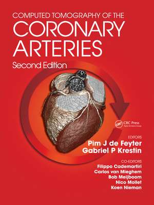 Computed Tomography of the Coronary Arteries de Pim J. de Feyter