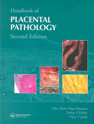 Handbook of Placental Pathology de Ona Marie Faye-Petersen