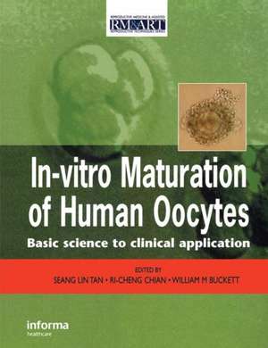 In Vitro Maturation of Human Oocytes de Seang Lin Tan