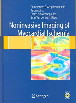 Noninvasive Imaging of Myocardial Ischemia de Constantinos Anagnostopoulos