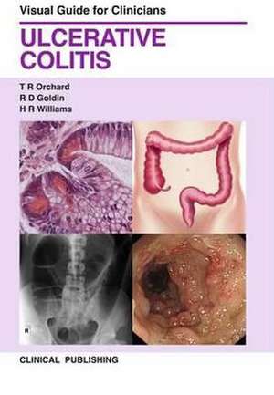 Ulcerative Colitis: Visual Guide for Clinicians de Orchard