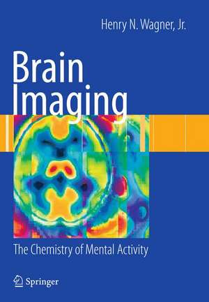 Brain Imaging: The Chemistry of Mental Activity de Henry N. Wagner