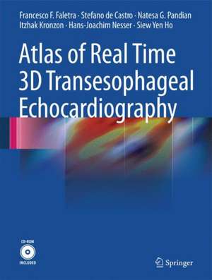 Atlas of Real Time 3D Transesophageal Echocardiography de Francesco F. Faletra