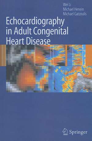 Echocardiography in Adult Congenital Heart Disease de Wei Li