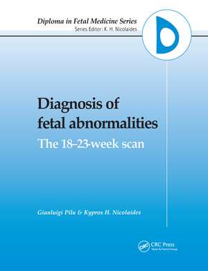 Diagnosis of Fetal Abnormalities: The 18-23-Week Scan de G. Pilu