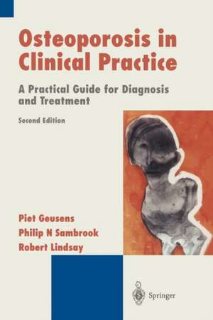 Osteoporosis in Clinical Practice: A Practical Guide for Diagnosis and Treatment de Piet Geusens