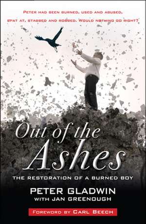 Out of the Ashes – The restoration of a burned boy de Peter Gladwin